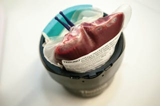 Unidad de sangre canina en un recipiente aislado